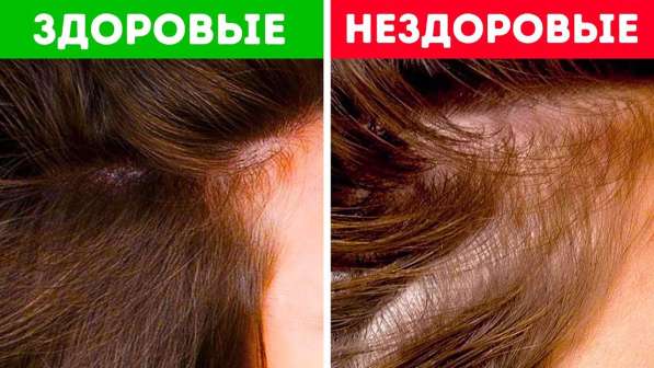 Решение проблемы выпадения волос, активация роста волос в Волгограде фото 7