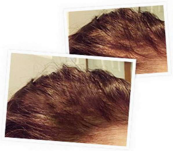 Спрей для восстановления и роста волос Ultra Hair Spray Syst в Москве